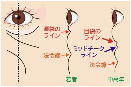 頬の断面でのアウトラインの変化イラスト